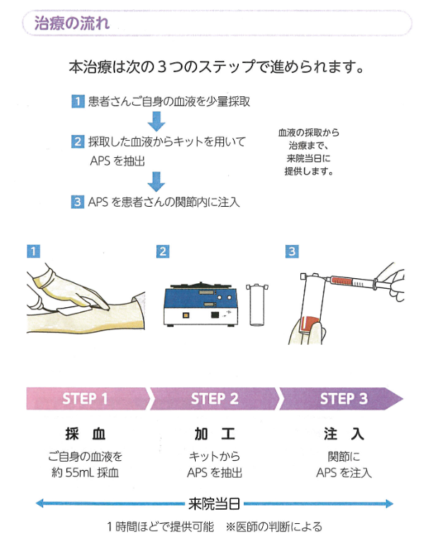 APS治療の流れ